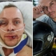 Gay Man Drugged and Beaten in West Hollywood