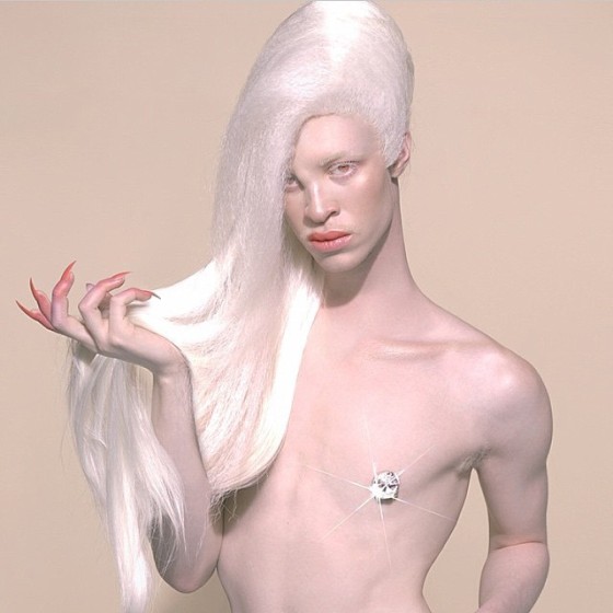 bleached